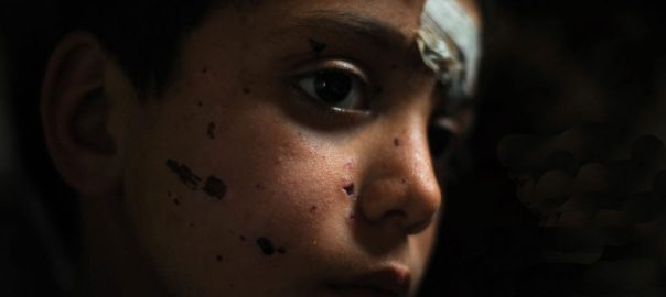Criança síria. Foto: UNICEF/NYHQ2012-0221/Kate Brooks